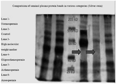 Image for - Correlation Studies on Human Seminal Plasma Proteins and Their Relation  with Semen Freezablity