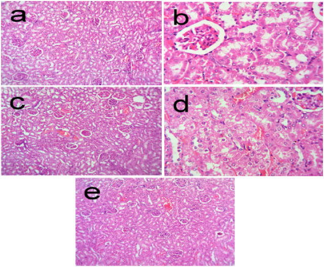Image for - Ameliorative Effects of Spirulina fusiformis Against Bromobenzene  Induced Nephrotoxicity in Rats: A Biochemical and Histoarchitectural Study
