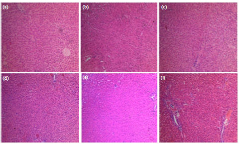 Image for - Prevention of Oxidative Damage of Liver, Kidney and Serum Proteins with Apoptosis of above Tissues in Guinea Pigs Fed on Carbonated Soft Drink by Vitamin C