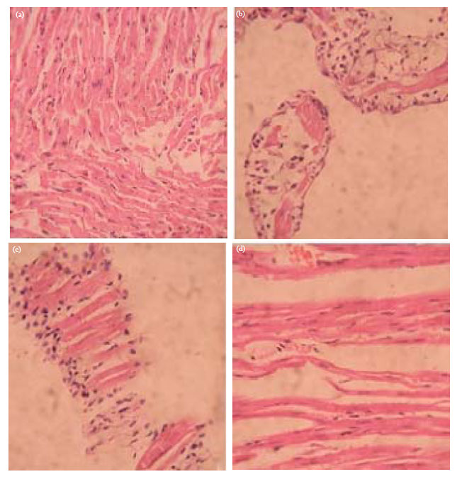 Image for - Cardioprotective Potential of Wedelia chinensi on Isoproterenol Induced Myocardial Rat