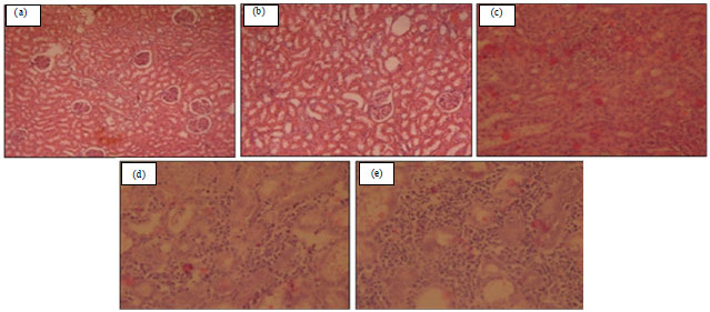 Image for - Effect of Melamine Adulteration on Body Weight, Liver and Kidney Histology and Liver Function Indices of Albino Rats