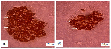 Image for - Immunohistochemical Expression of Insulin and Glucagon,Superoxide Dismutase and Catalase Activity in Pancreas inHyperglycaemia Condition