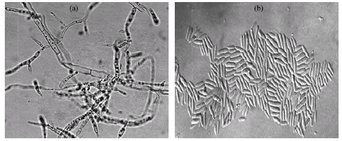 Image for - Biology and Partial Sequencing of an Endophytic Fusarium oxysporum and Plant Defense Complex