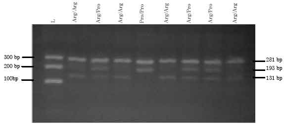 Image for - Detection of Arg72Pro Polymorphism of the Tumor Suppressor Gene (TP53) by a Rapid One-step Tetra-primer Amplification Refractory Mutation System-PCR