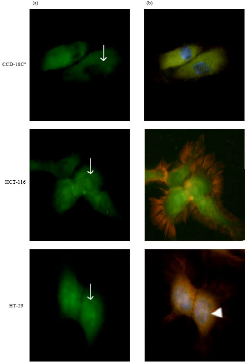 Image for - Comparative Phosphorylation Profiles of Focal Adhesion Kinase among Cancer Colon Cell Lines and Tissues