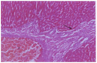 Image for - The Salutary Role of Allium cepa Extract on the Liver Histology, Liver Oxidative Status and Liver Marker Enzymes of Rabbits Submitted to Alcohol-induced Toxicity