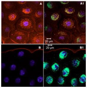 Image for - Nuclear Association of Nonmuscle Myosin-II within the Giant Cells of Drosophila melanogaster Salivary Gland Organ: Tail Domain Specifies Perinuclear Oligomerization