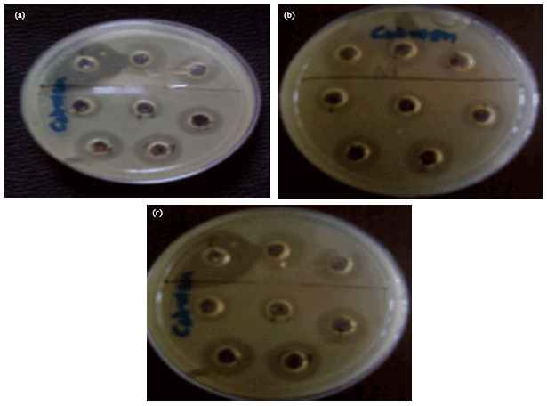 Image for - Purification and Physicochemical Characterization of Anti-Gardnerella vaginalis Bacteriocin HV6b Produced by Lactobacillus fermentum Isolate from Human Vaginal Ecosystem