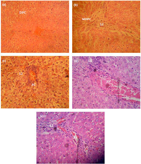 Image for - Effect of Consumption of Corchorus olitorius L., in Carbon Tetrachloride-Induced Liver Damage in Male Wistar Rats