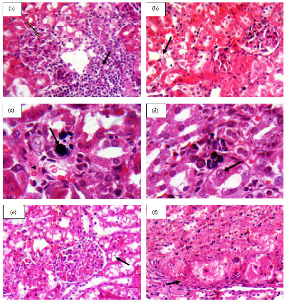 Image for - Alpha-Lipoic Acid Protects Rat Kidney Against Oxidative Stress-Mediated DNA Damage and Apoptosis Induced by Lead