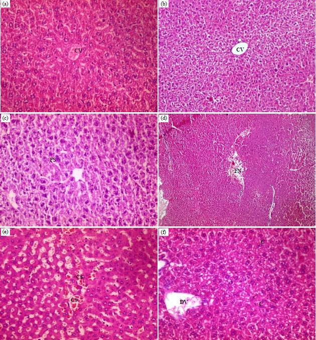 Image for - Efficacy of α-lipoic Acid Against Oxidative Stress and Histopathological Changes Induced by Dimethylnitrosamine in Liver Male Mice