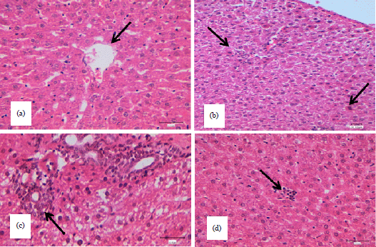 Image for - Biochemical and Molecular Investigation of Antioxidant Enzymes in Liver Tissue of Rats Intoxicated with Carbon Tetrachloride and Treated with Aqueous Extract of Fenugreek (Trigonella foenum-graecum L.)