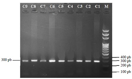 Image for - Genetic Factors Associated with Response to Breast Cancer Chemotherapy in Burkina Faso: Case of the CHEK2 1100delC Mutation