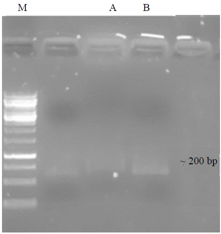 Image for - Simultaneous Nucleic Acids Separation and Extraction Using Silica Gel-Agarose Matrix Gel