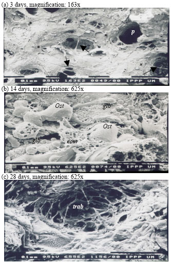 Image for - Osteogenic Expression of Bone Marrow Stromal Cells on PCLTF Scaffold: In vitro Study