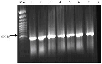 Image for - Evaluation of Polymerase Chain Reaction for Rapid Detection of E. coli Strains: A Preliminary Study