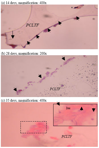 Image for - Osteogenic Expression of Bone Marrow Stromal Cells on PCLTF Scaffold: In vitro Study