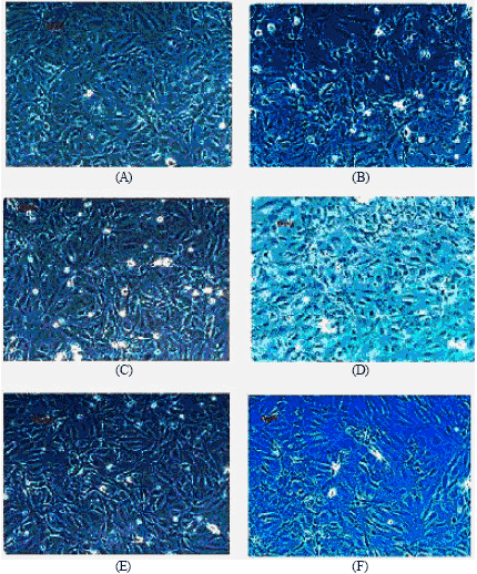 Image for - Protective Effect of Fresh Apple Skin Extract on Human Umbilical Vein Endothelial Cells Against Glycated Protein-iron Chelate Induced Toxicity