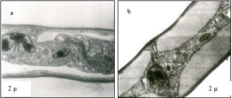 Image for - Ultrastructural Alterations in the Gills of Macrobrachium rosenebergii  Acclimated to Three Temperatures