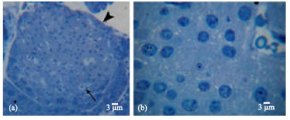 Image for - Effect of Nigella sativa L. and Thymoquinone on Streptozotocin Induced Cellular Damage in Pancreatic Islets of Rats