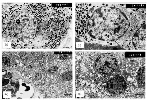 Image for - Effect of Nigella sativa L. and Thymoquinone on Streptozotocin Induced Cellular Damage in Pancreatic Islets of Rats
