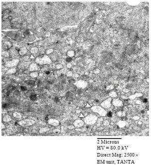 Image for - Histological and Ultra Structural Study of 5-fluorouracil-induced Small Intestinal Mucosal Damage in Rats