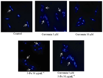 Image for - Cell Proliferation and DNA Damage Study by SCGE in Fission Yeast Exposed to Curcumin and 5-fluorouracil