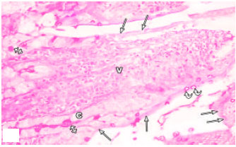 Image for - Histological and Ultra Structural Study of 5-fluorouracil-induced Small Intestinal Mucosal Damage in Rats