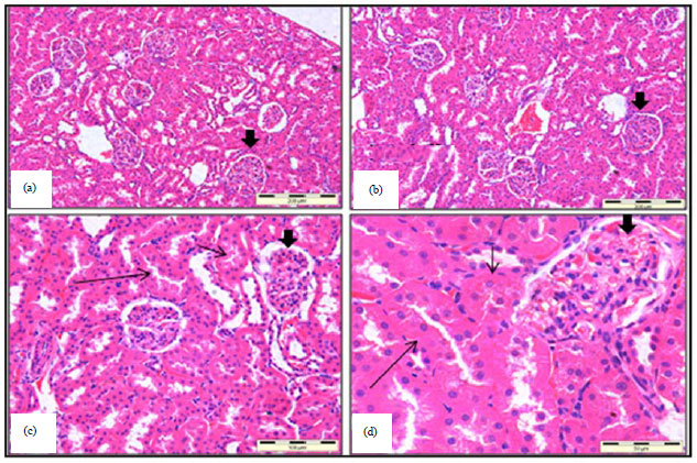 Image for - Effects on Renal Histology, Renal Metabolizing Enzymes and Oxidative Stress Biomarkers in Rats Administered Zerumbone Against Osteoarthritis