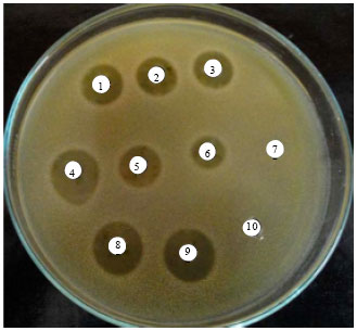 Image for - Antimicrobial Spectrum of Anti-Gardnerella vaginalis Bacteriocin Producing Lactobacillus fermentum HV6b Against Bacterial Vaginosis Associated Organisms