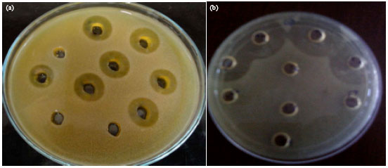 Image for - Antimicrobial Spectrum of Anti-Gardnerella vaginalis Bacteriocin Producing Lactobacillus fermentum HV6b Against Bacterial Vaginosis Associated Organisms