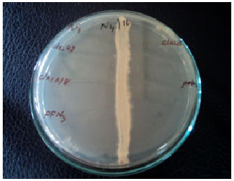 Image for - Studies on Actinomycetes Collected from Pond Sediment Inhibiting Fish Pathogenic  and Human Clinical Bacterial Isolates
