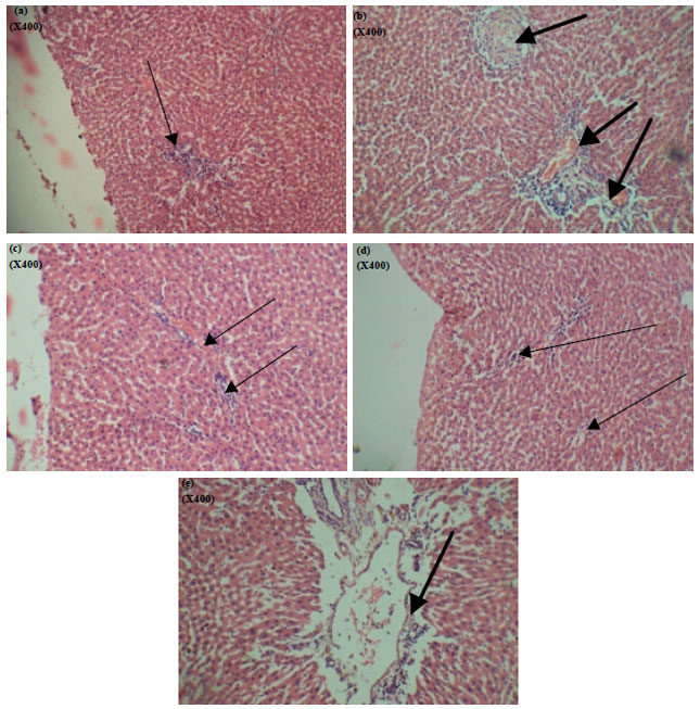 Image for - Effects of Anti-erectile Dysfunction Drug on some Key Tissues in Healthy Male Rats