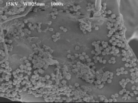 Image for - Immobilization of Aspergillus niger in Polyurethane Foam for Citric Acid Production from Carob Pod Extract