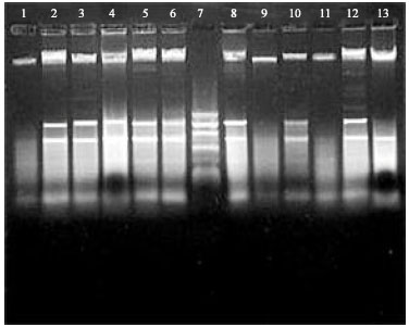 Image for - Multiple-Antibiotic Resistance and Plasmid Profiles of Salmonella enteritidis Isolated from Retail Chicken Meats