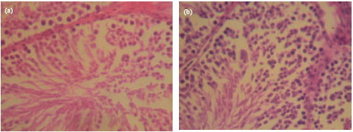 Image for - Studies on Some Biochemical and Histological Changes Associated with Long Term Consumption of Leaves of Ocimum gratissimum L. in Male Rats