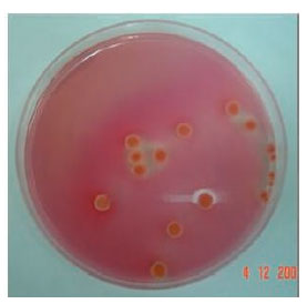 Image for - Effect of Sample Pre-enrichment and Characters of Food Samples on the Examination for the Salmonella by Plate Count Method and Fluorescent in-situ Hybridization Technique