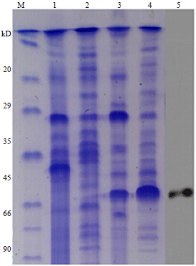 Image for - Development of an Indirect Competitive Enzyme-linked Immunosorbent Assays Method Based on Immunomagetic-bead for Analyzing Listeria monocytogenes in Food