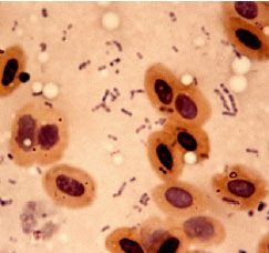 Image for - An Outbreak of Concurrent Histomonas meleagridis and Enteroccocus fecalis Infection in Ducks