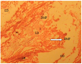 Image for - Some Morphological Findings on the Heart of Adult Wistar Rats Following Experimental Artesunate Administration