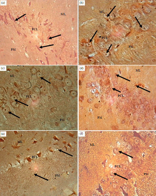 Image for - Behavioural and Microstructural Evaluation of the Hippocampus of Adult Wistar Rats Following Artequin Administration