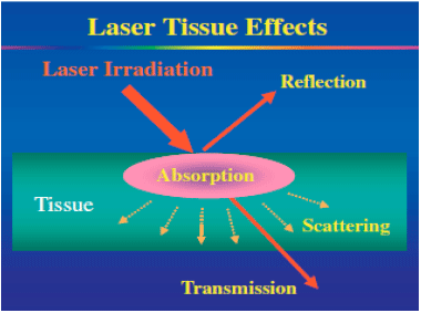 Image for - Lasers in Periodontics-A Review