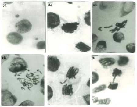 Image for - Protective Effects of Some Antioxidant Metals against Chromosomal Damage  Induced by Cadmium in Vicia faba plants
