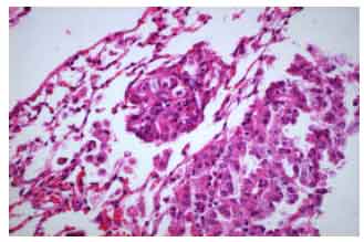 Image for - Risk of Gastrointestinal Cancer in Mice after Consuming Salted and Dried Fish in Van-Ercis Region