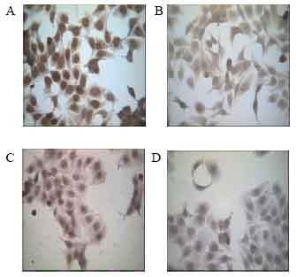 Image for - Differential Expression of TS and TP in Tamoxifen Resistant Subline of Human  Breast Cancer T47D Cells