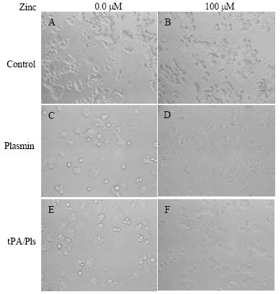 Image for - Zinc Inhibits Tumor Metastasis by Regulating Plasminogen Activation