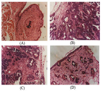 Image for - Protective Effect of Kalpaamruthaa on Altered Glycoprotein Component Levels and Membrane Stability In Mammary Carcinoma