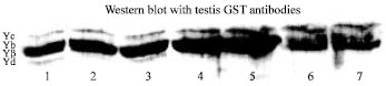 Image for - Tissue Specific Expression of Testicular Glutathione S-transferases on β-methylcholanthrene Treatment