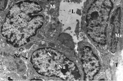 Image for - Tamoxifen and Melatonin Differentially Influence Apoptosis of Normal Mammary Gland Cells: Ultrastructural Evidence and p53 Expression