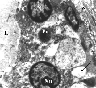 Image for - Tamoxifen and Melatonin Differentially Influence Apoptosis of Normal Mammary Gland Cells: Ultrastructural Evidence and p53 Expression